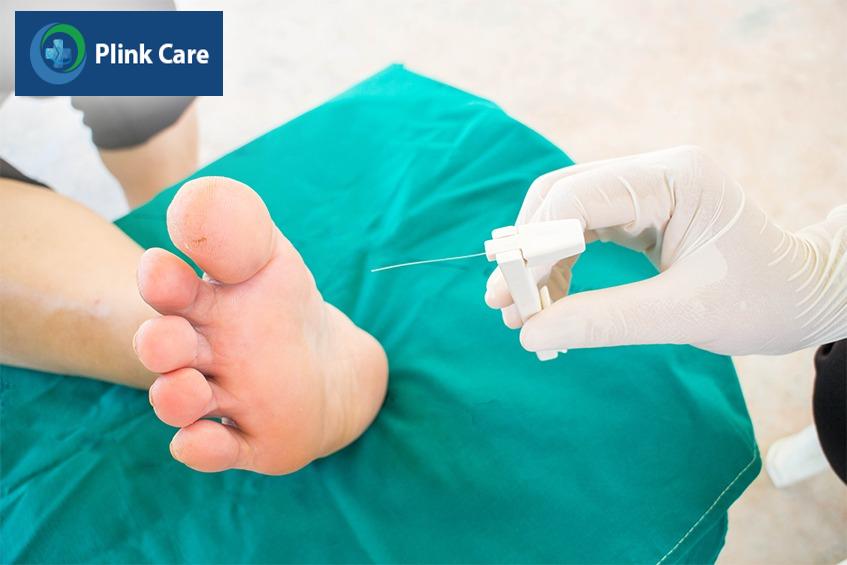 Người bệnh tiểu đường nên kiểm tra chân hằng ngày