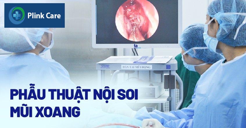 nội soi mũi xoang