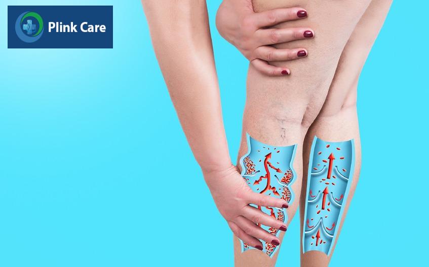 siêu âm duplex chẩn đoán bệnh gì
