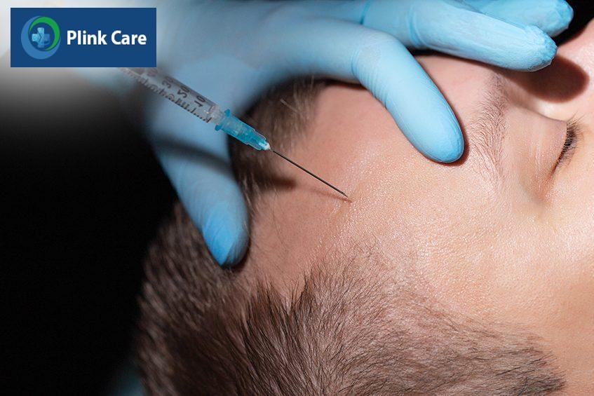 tiêm huyết cầu điều trị rụng tóc mảng