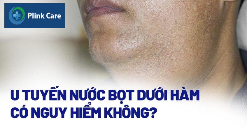 U tuyến nước bọt dưới hàm là gì?