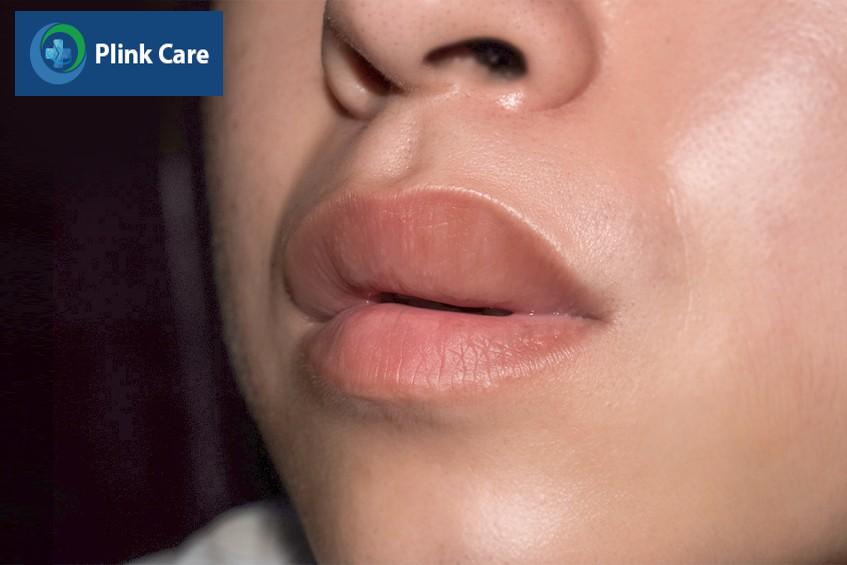 khi nào cần gặp bác sĩ