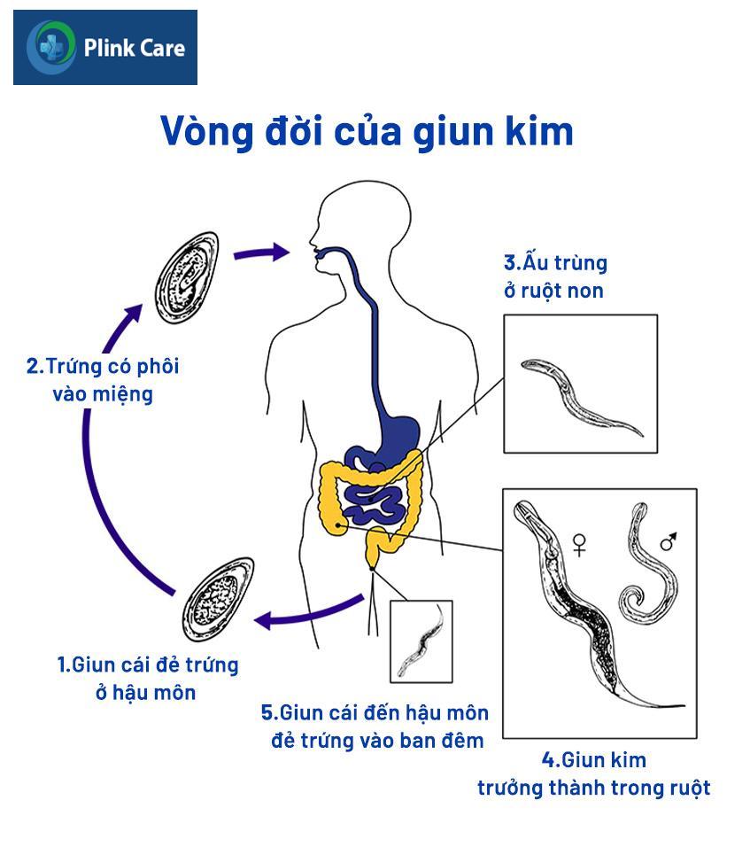 vòng đời của trứng giun kim