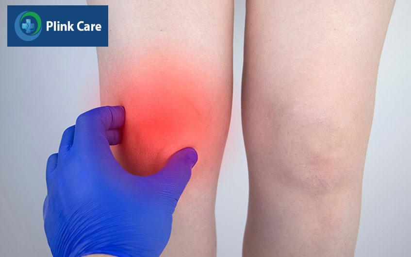 bao hoạt dịch khớp gối bị viêm