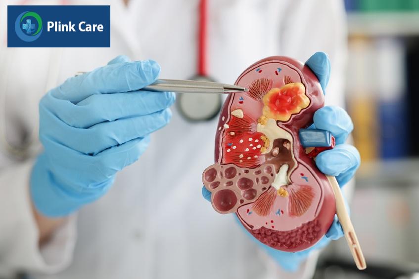 Bên trong thận có chứa các tiểu cầu thận