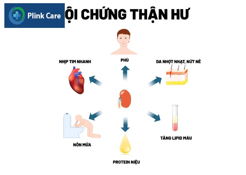 Các triệu chứng thường gặp của hội chứng thận hư ở trẻ