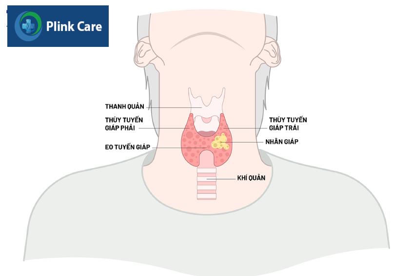 Chăm sóc đúng cách sẽ giúp hạn chế hình thành sẹo