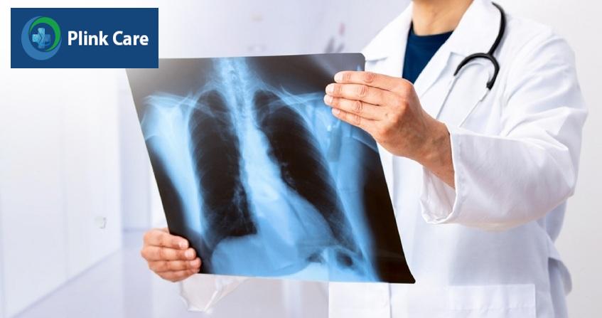 Chụp X-quang giúp chẩn đoán chính xác hơn về cơn đau ngực phải