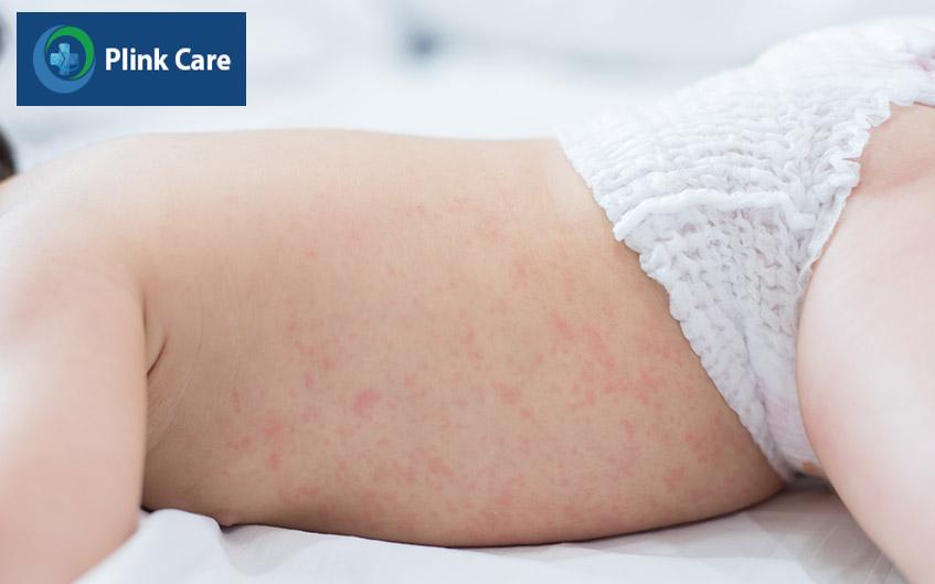 dấu hiệu khi trẻ mắc bệnh