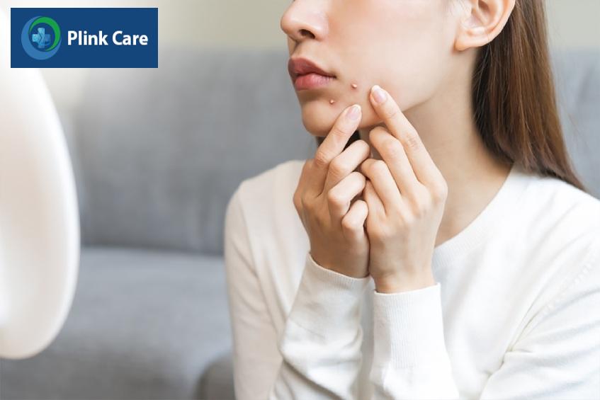 dấu hiệu mụn trứng cá mủ