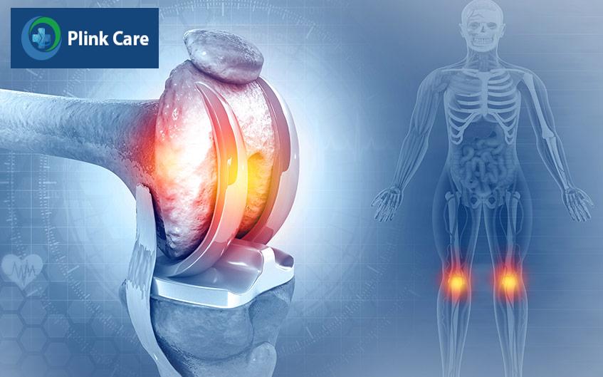 điều trị cứng khớp đầu gối