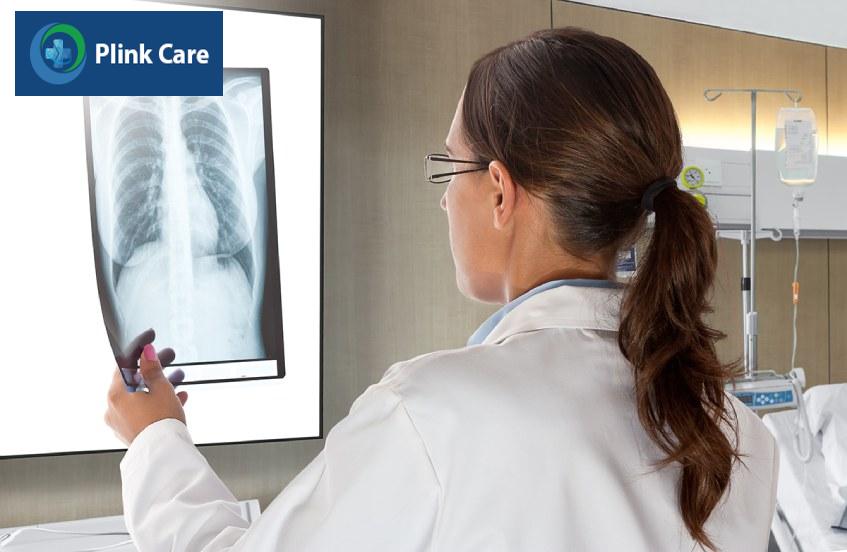 đọc kết quả xquang tràn dịch màng phổi