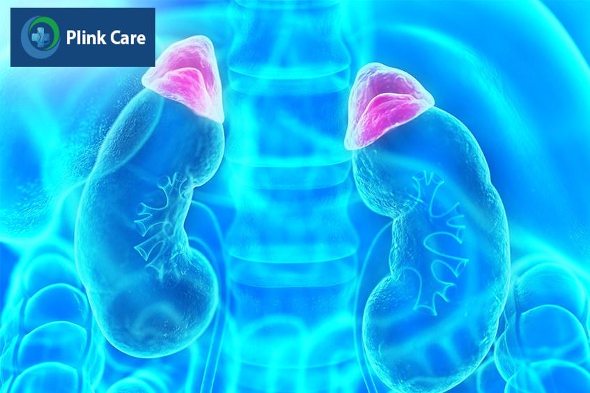 Hội chứng Cushing có nguồn gốc từ u vỏ thượng thận