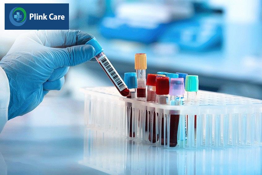Mức testosterone bình thường ở nữ giới