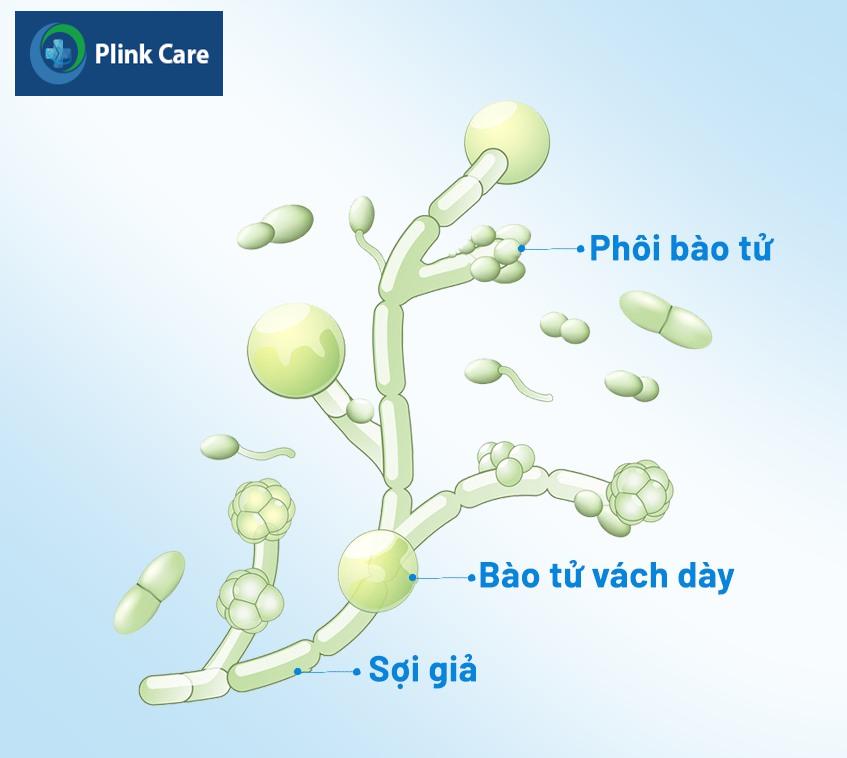 nấm bao quy đầu là bệnh gì