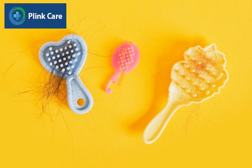 rụng tóc vành khăn có phải do thiếu chất