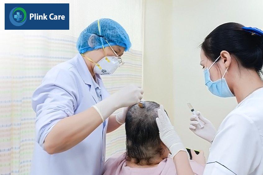 Lăn kim trị rụng tóc tại PlinkCare