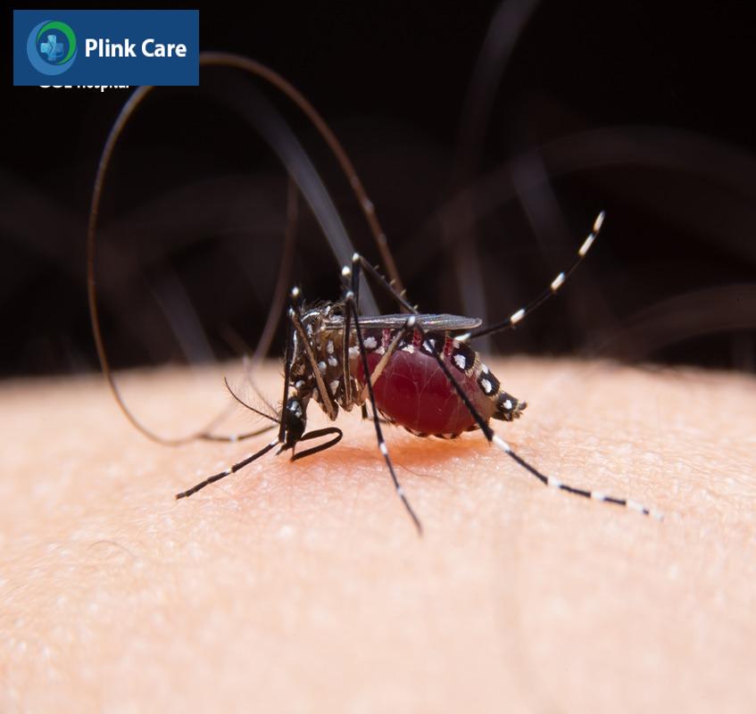 Trẻ bị nhiễm virus gây bệnh sốt xuất huyết