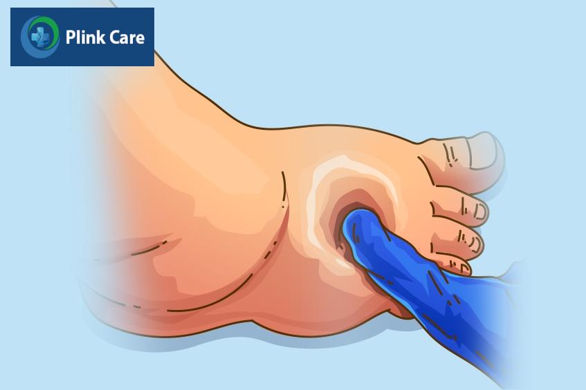 trẻ cần tuân thủ nghiêm ngặt quy định của bác sĩ