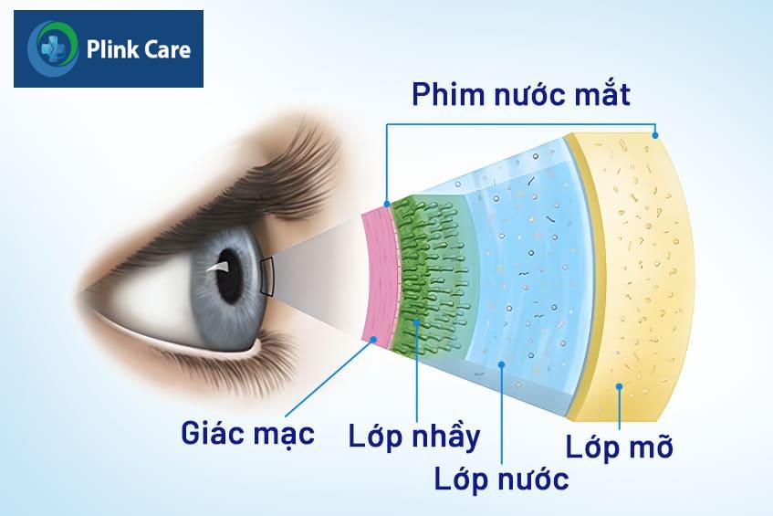 trị khô mắt tại nhà