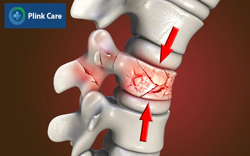 vùng đốt sống bị tổn thương