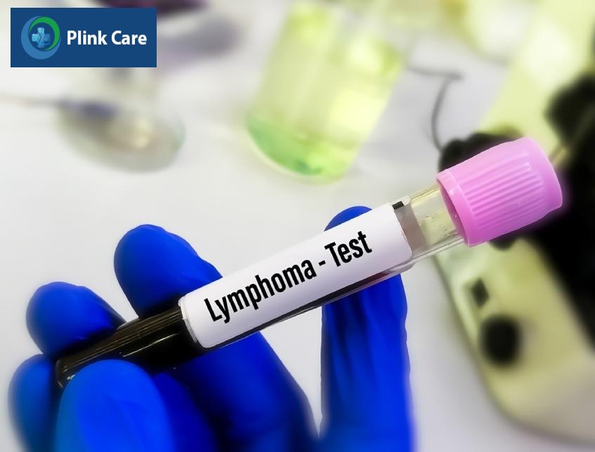xét nghiệm chẩn đoán lymphoma hodgkin