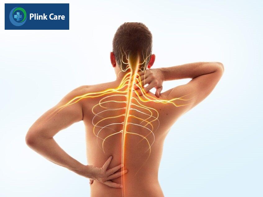 zona thần kinh gây tổn thương cột sống