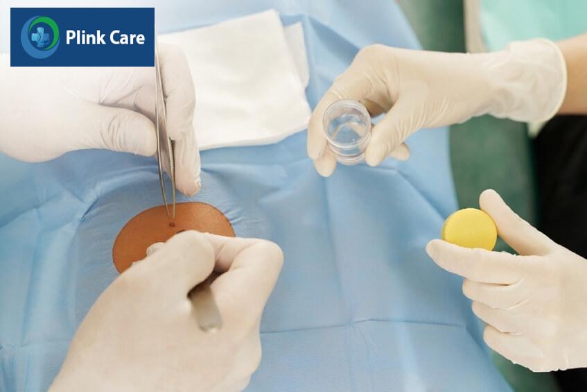 bác sĩ điều trị ung thư hắc tố da