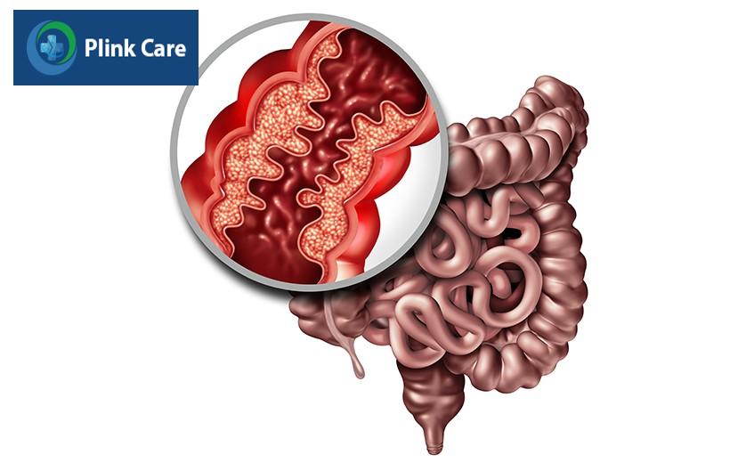 các bệnh đường ruột
