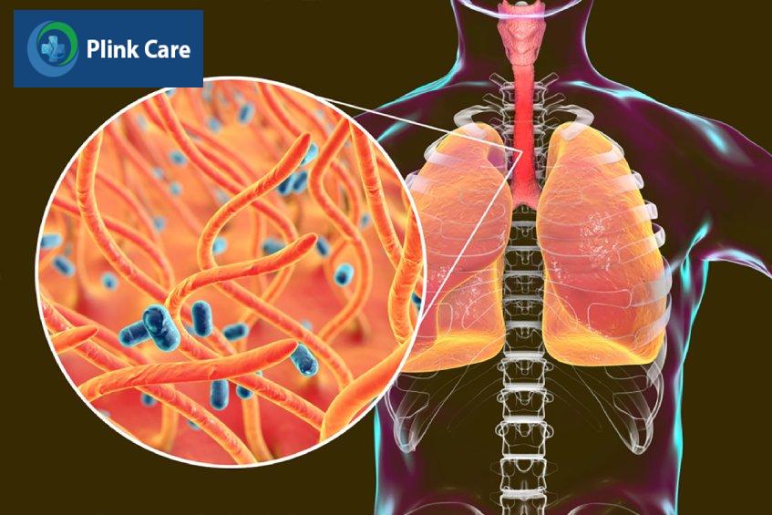 Các bệnh lý về đường hô hấp, suy hô hấp