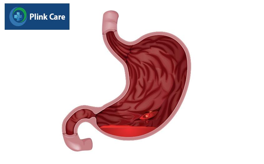các bệnh về đường tiêu hóa