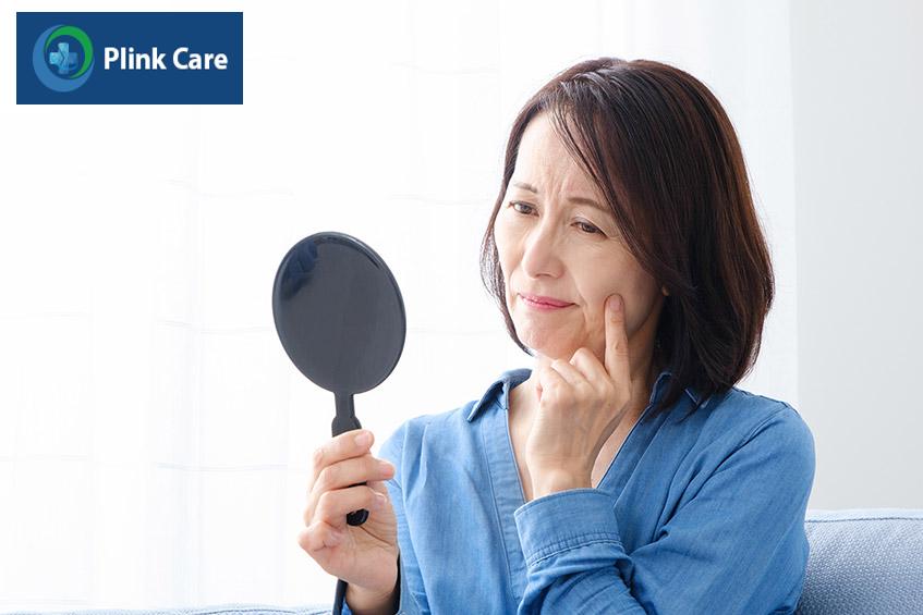 các nếp nhăn lộ rõ