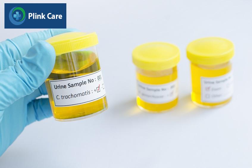 các loại rối loạn chức năng tình dục