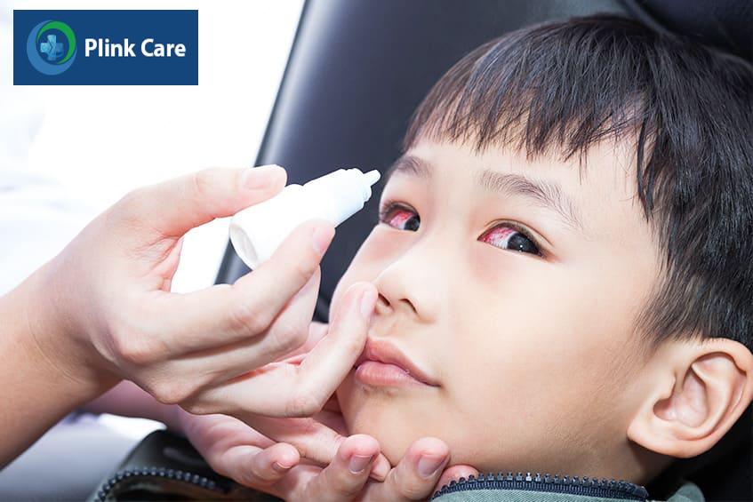 cách chữa đau mắt đỏ tại nhà