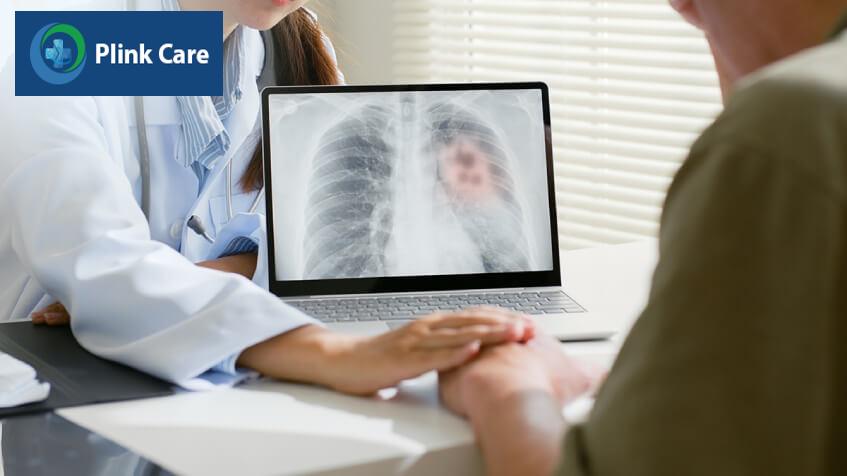 chẩn đoán ung thư phổi giai đoạn đầu
