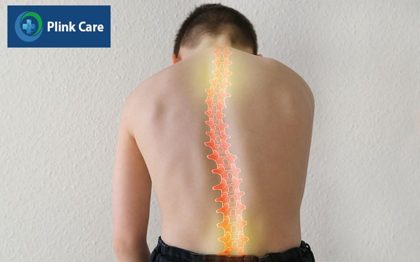 chụp x quang lưng có phải cởi quần áo không