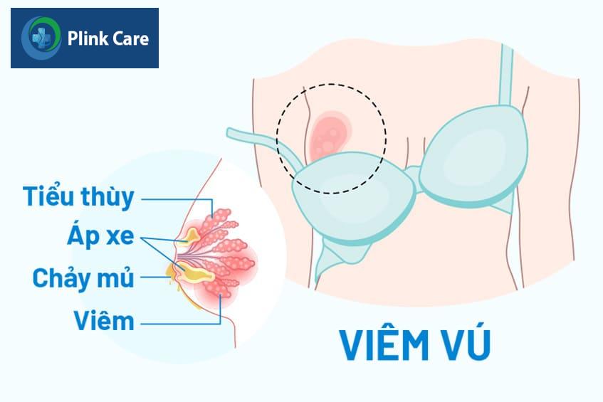 điều trị đầu ti bị khô