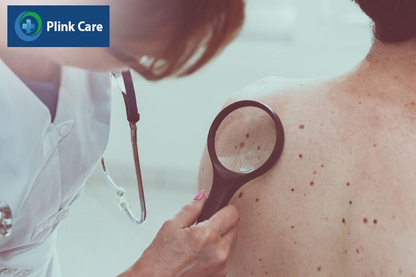 điều trị ung thư hắc tố da có thể cá thể hóa