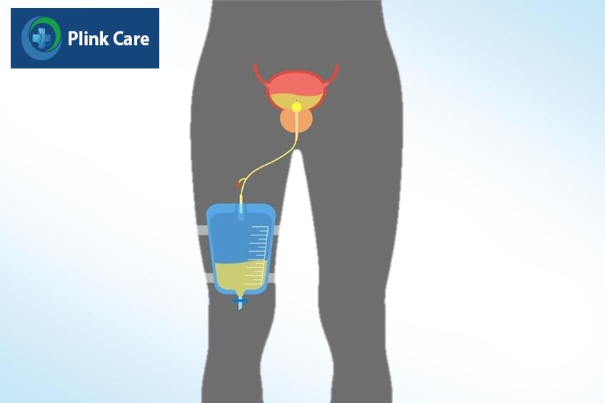 chăm sóc sau khi đặt ống thông tiểu