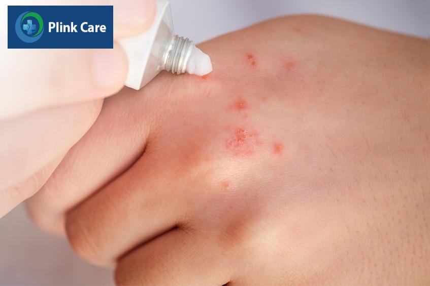 người bệnh chỉ cần dùng một lớp mỏng
