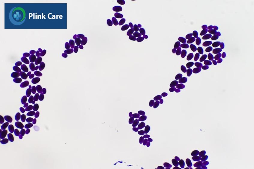 Hình ảnh nấm Candida dưới kính hiển vi