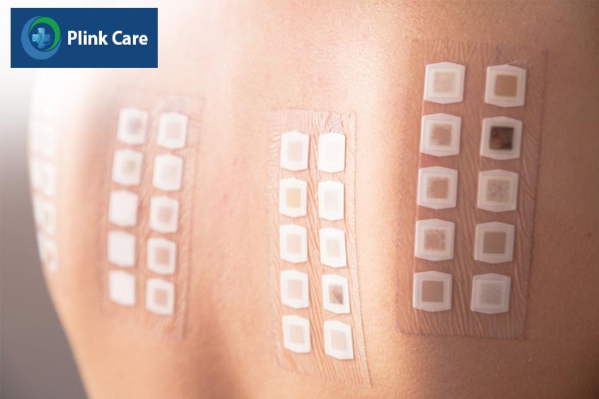 patch test có an toàn không