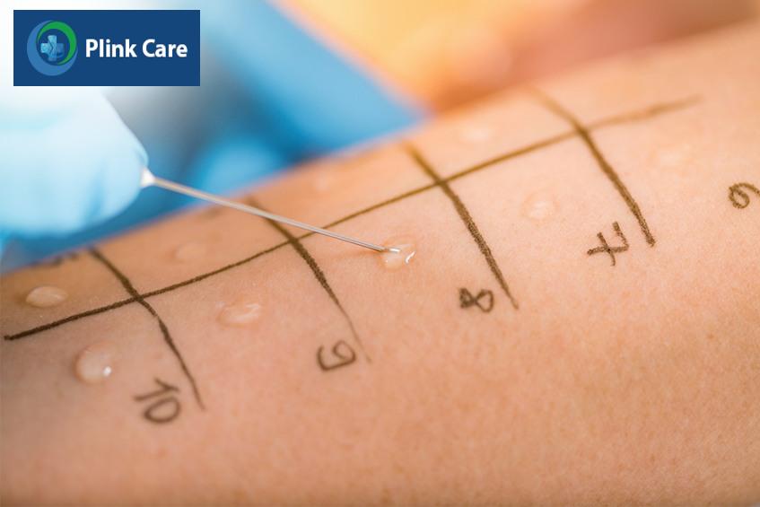 quy trình thực hiện test lẩy da