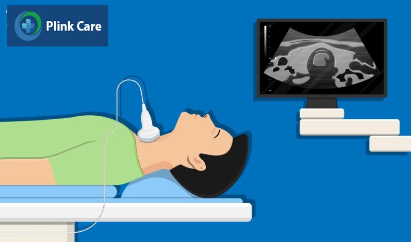 RFA là phương pháp sử dụng nhiệt để hủy khối u