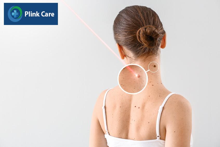 tiên lượng ung thư da sống được bao lâu