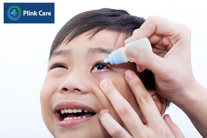 Trẻ bị đau mắt đỏ nên vệ sinh mắt sạch sẽ