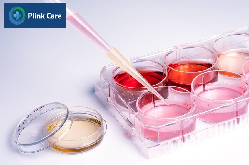 ưu điểm của tế bào gốc dây rốn