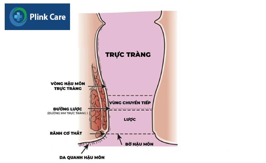 vị trí có thể xuất hiện ung thư hậu môn