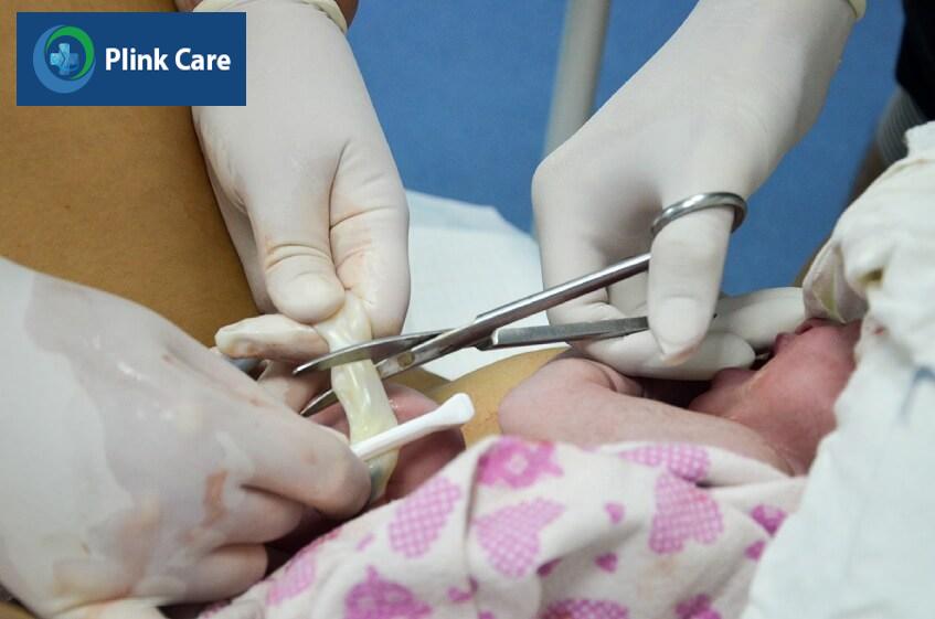 bác sĩ thu thập tế bào gốc trẻ sơ sinh