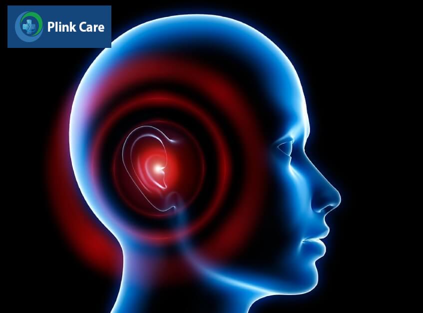 bệnh u dây thần kinh thính giác